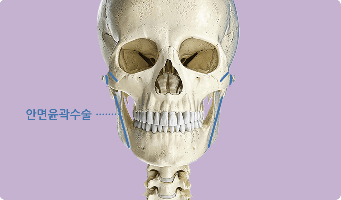 2in1 페이스 기술 / 안면윤곽 / 경조직(뼈)