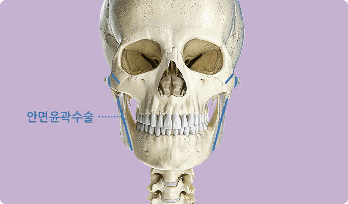 2 in 1 페이스 기술 / 안면윤곽 / 경조직(뼈)