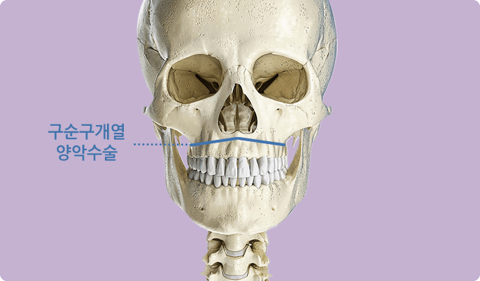 2in1 페이스 기술 / 구순구개열 / 경조직(뼈)