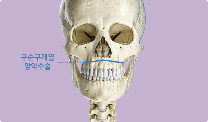 2 in 1 페이스 기술 / 구순구개열 / 경조직(뼈)