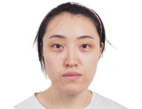 후